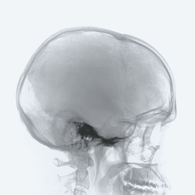  RÖKO LEIPZIG – Vor Ort beim 107. Deutschen Röntgenkongress 2026 